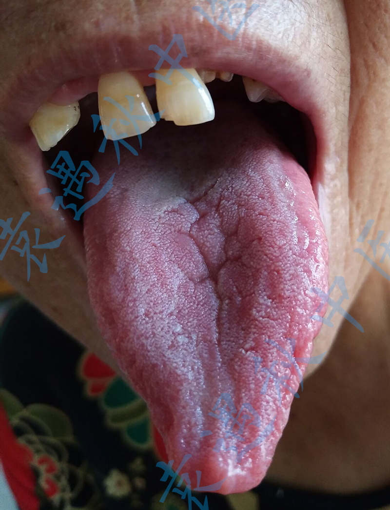 舌苔 经方